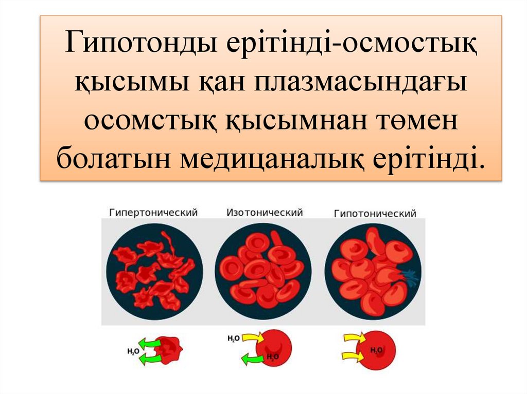 Гипотонды ерітінді-осмостық қысымы қан плазмасындағы осомстық қысымнан төмен болатын медицаналық ерітінді.