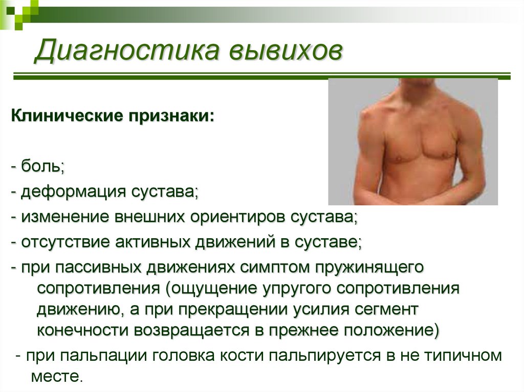 Диагностика вывихов