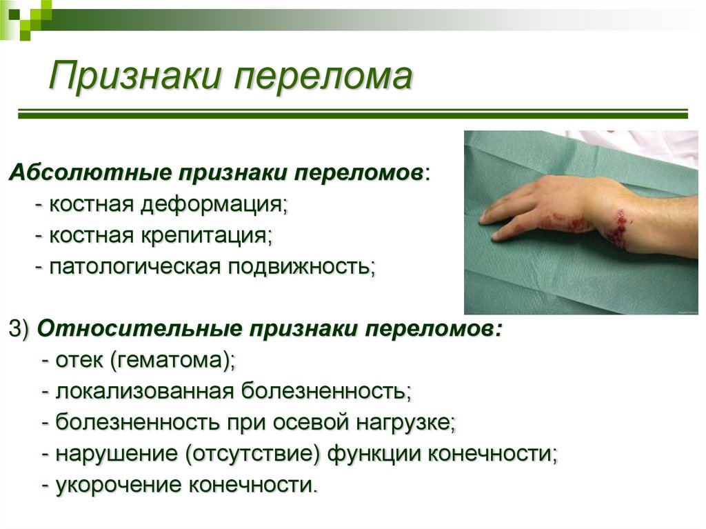 Признаки перелома