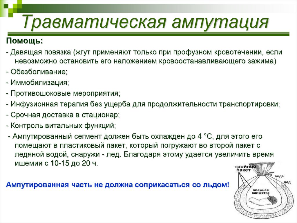 Травматическая ампутация