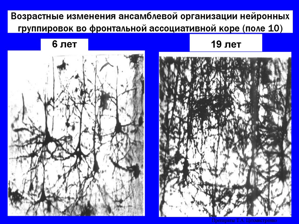 Возрастные изменения ансамблевой организации нейронных группировок во фронтальной ассоциативной коре (поле 10)