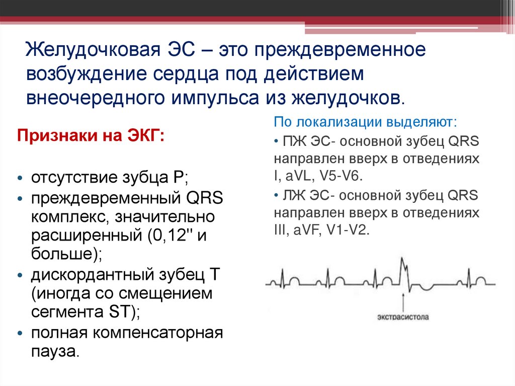 Желудочковая ЭС – это преждевременное возбуждение сердца под действием внеочередного импульса из желудочков.