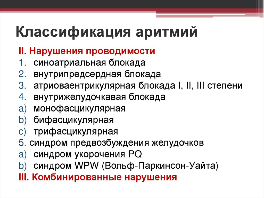 Классификация аритмий