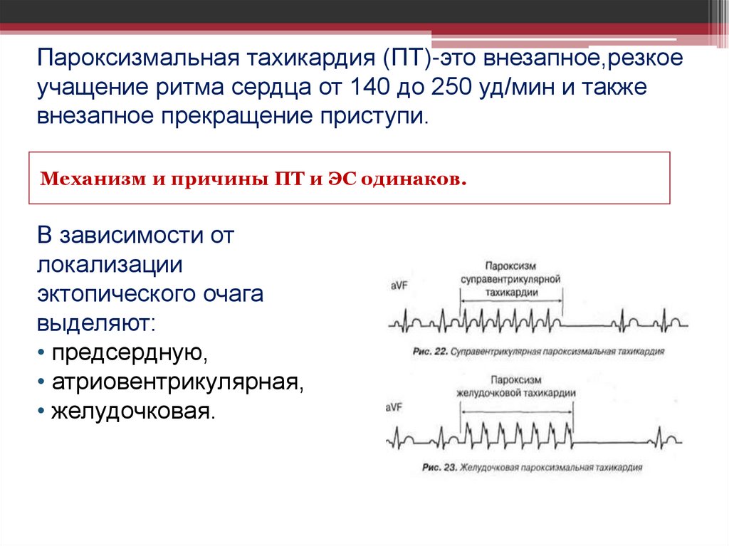 Пароксизмальная тахикардия (ПТ)-это внезапное,резкое учащение ритма сердца от 140 до 250 уд/мин и также внезапное прекращение
