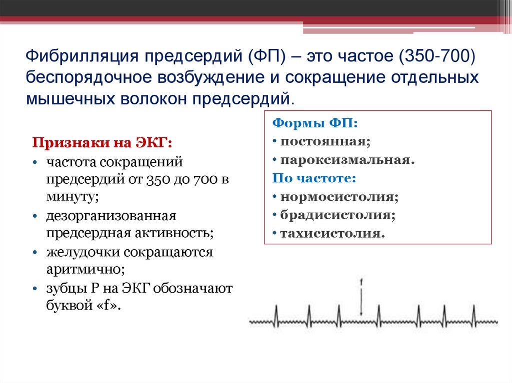 Фибрилляция предсердий (ФП) – это частое (350-700) беспорядочное возбуждение и сокращение отдельных мышечных волокон