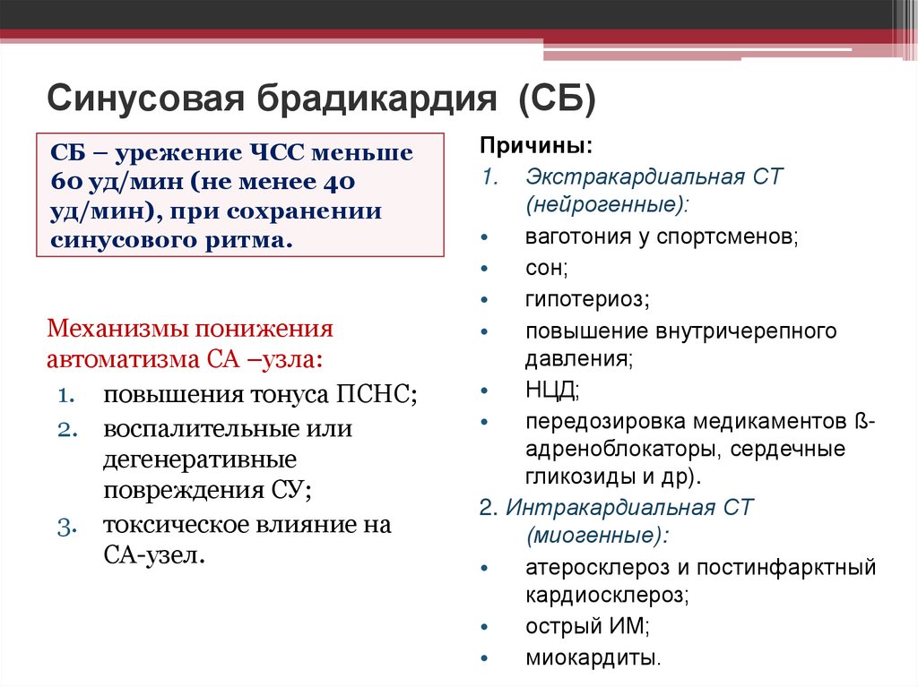 Синусовая брадикардия (СБ)