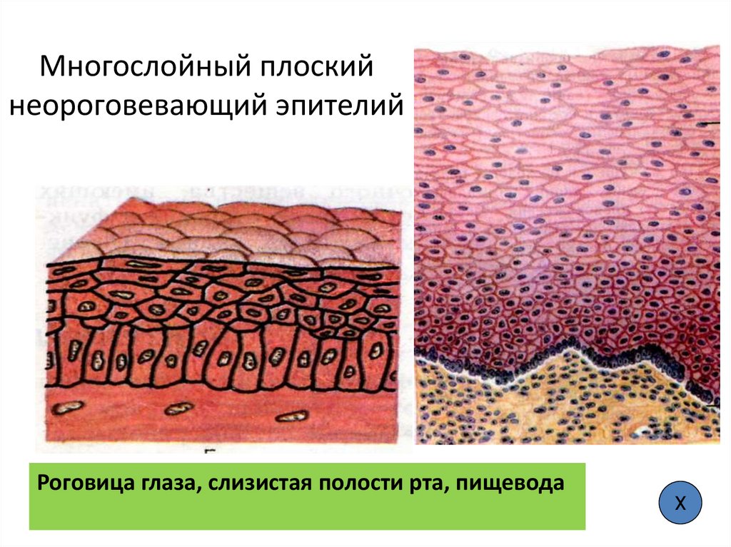 Многослойный плоский неороговевающий эпителий