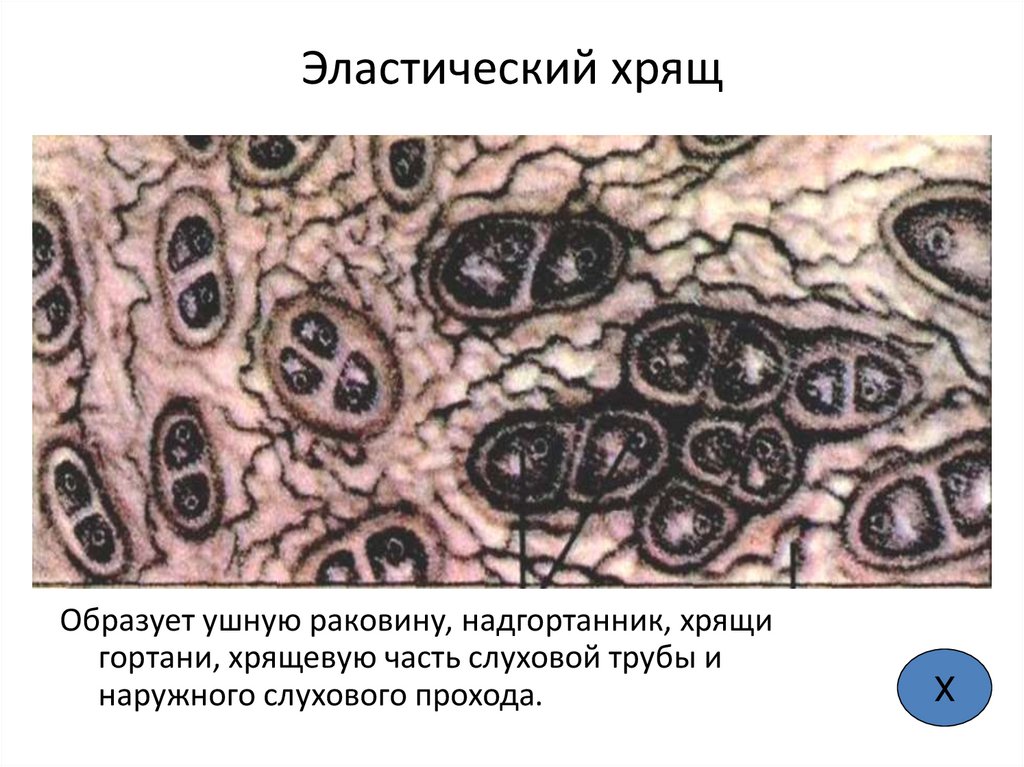 Эластический хрящ