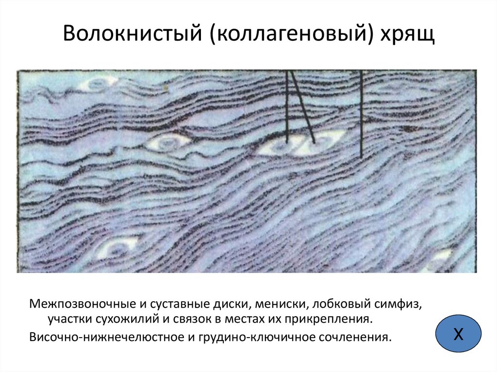 Волокнистый (коллагеновый) хрящ