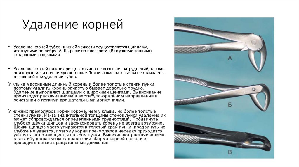 Удаление корней