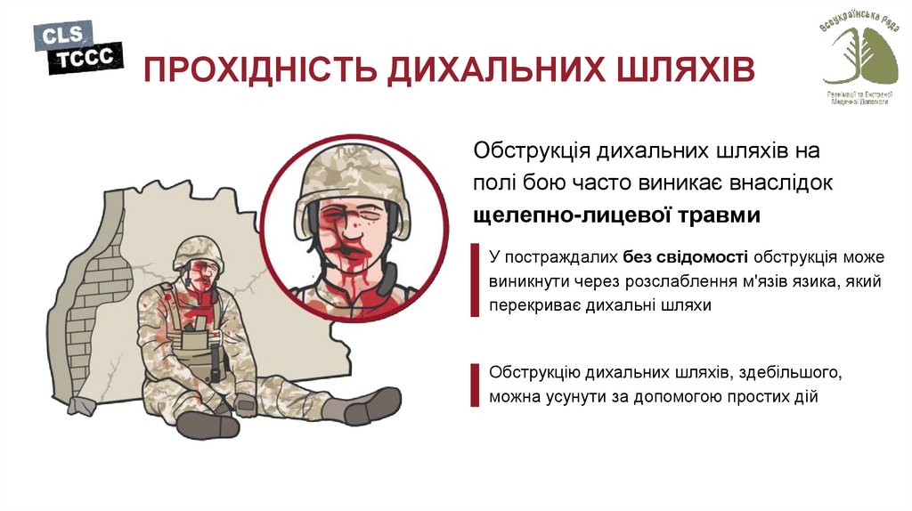 ПРОХІДНІСТЬ ДИХАЛЬНИХ ШЛЯХІВ