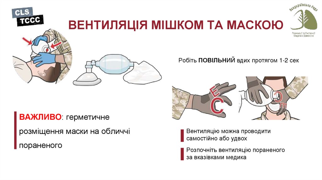 ВЕНТИЛЯЦІЯ МІШКОМ ТА МАСКОЮ