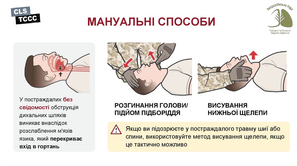МАНУАЛЬНІ СПОСОБИ