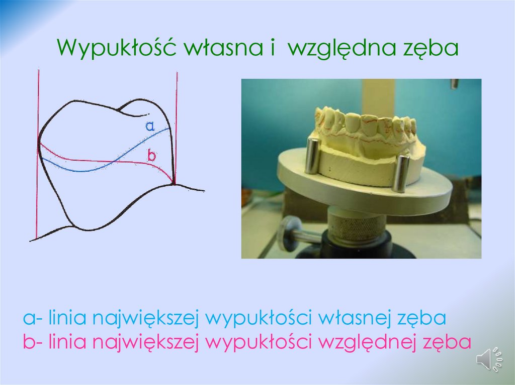 Wypukłość własna i względna zęba