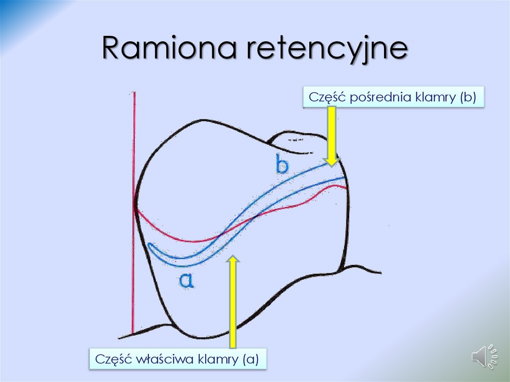 Ramiona retencyjne
