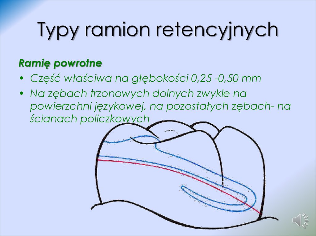 Typy ramion retencyjnych