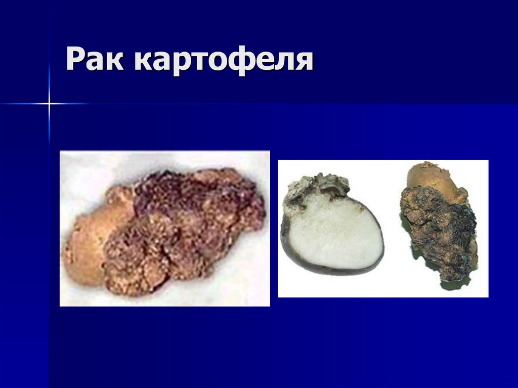 Рак картофеля