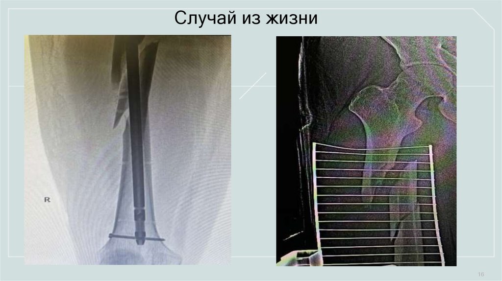 Случай из жизни