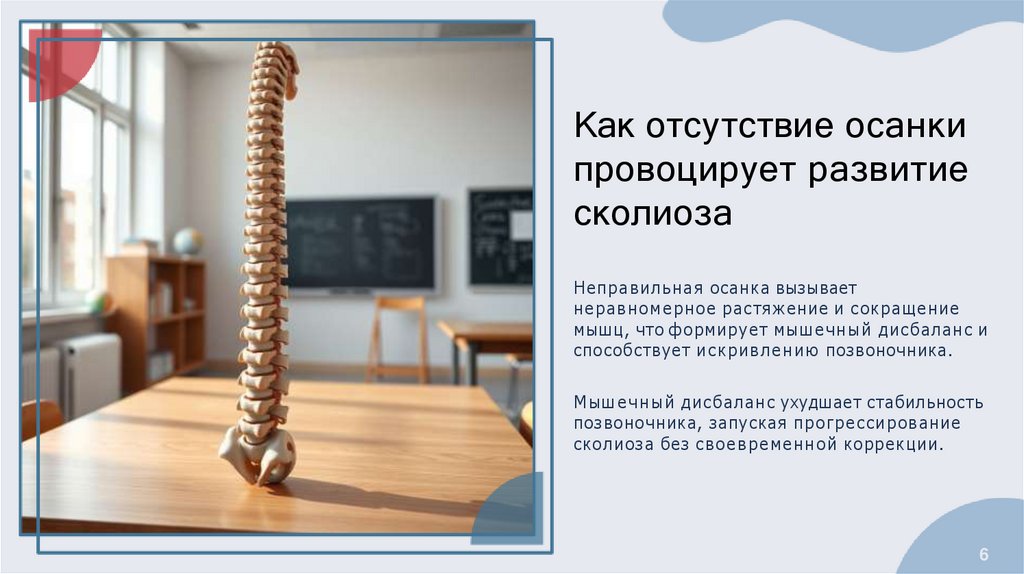 Как отсутствие осанки провоцирует развитие сколиоза