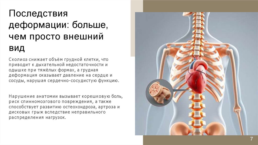Последствия деформации: больше, чем просто внешний вид