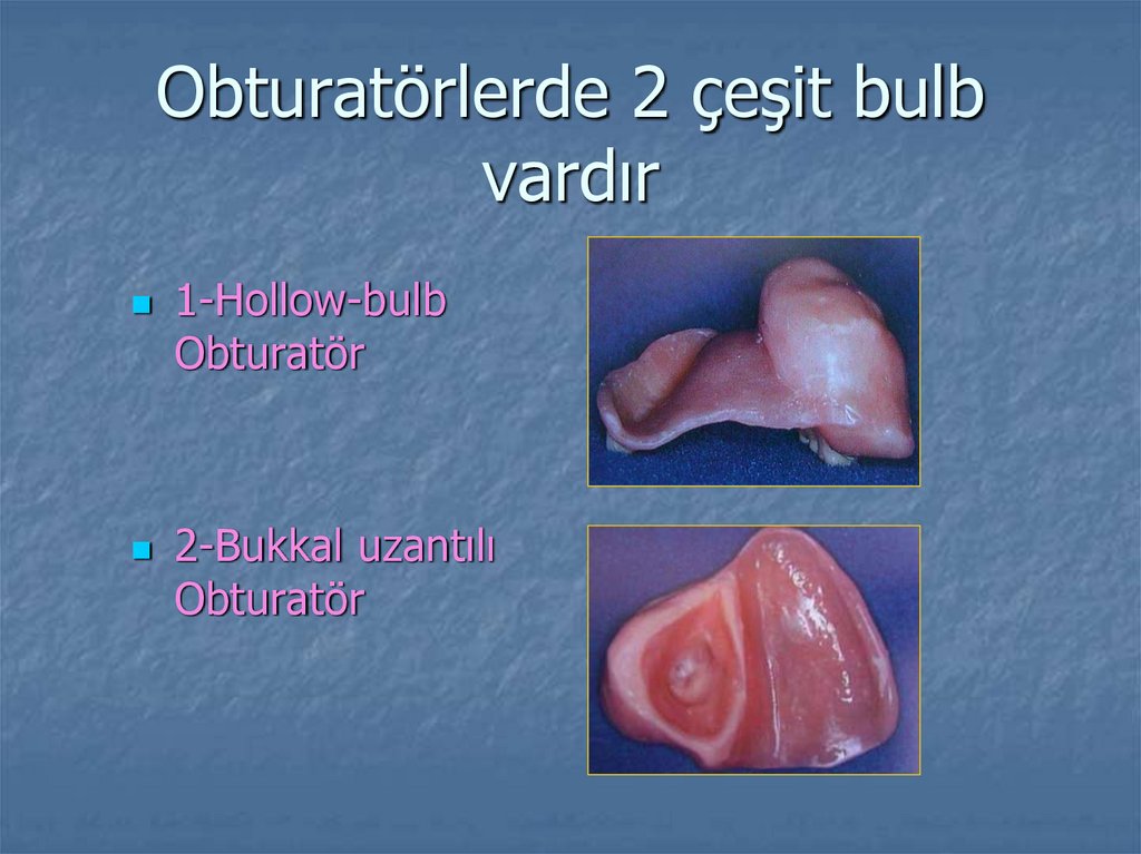 Obturatörlerde 2 çeşit bulb vardır