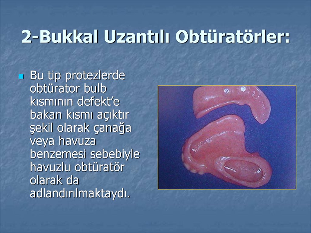 2-Bukkal Uzantılı Obtüratörler: