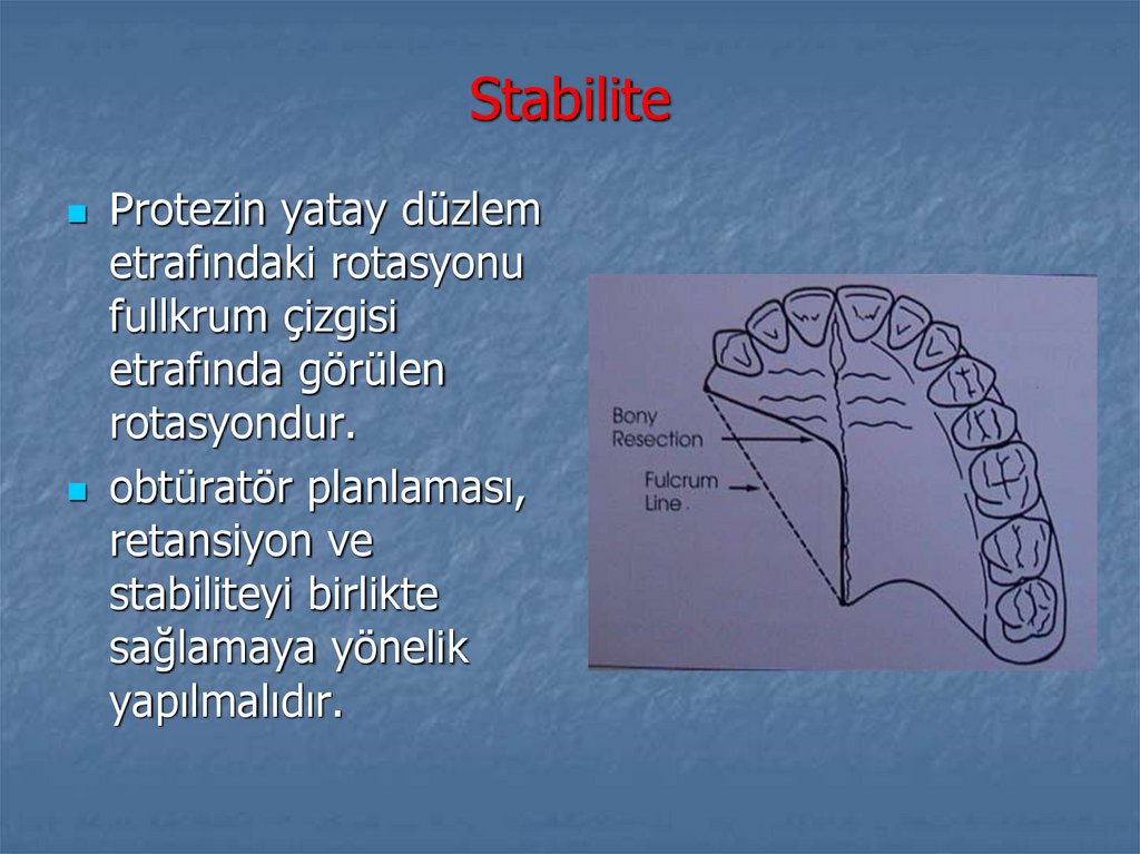 Stabilite