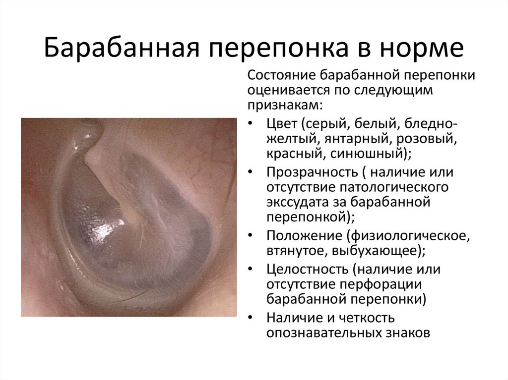 Барабанная перепонка в норме