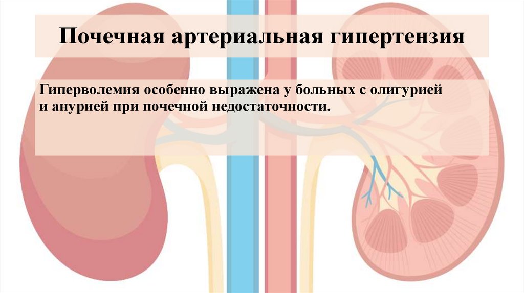 Почечная артериальная гипертензия