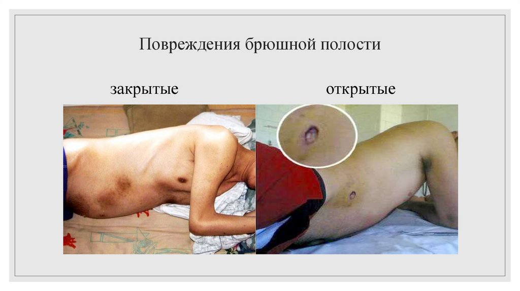 закрытые открытые