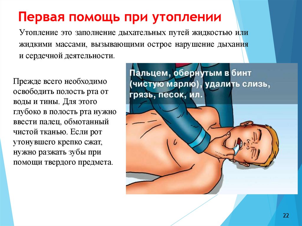 Первая помощь при утоплении