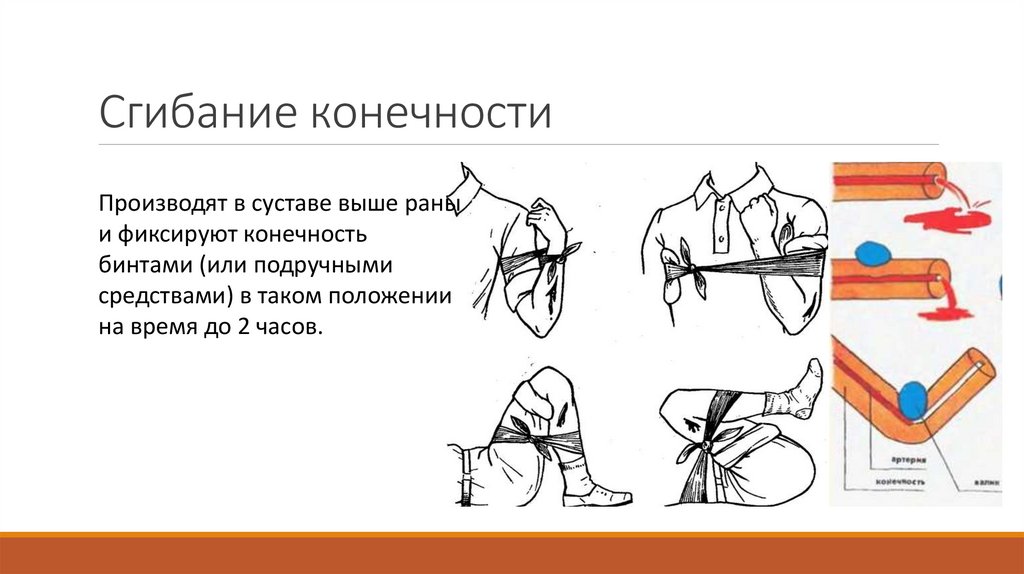 Сгибание конечности