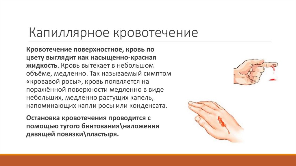 Капиллярное кровотечение