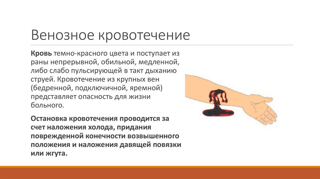 Венозное кровотечение