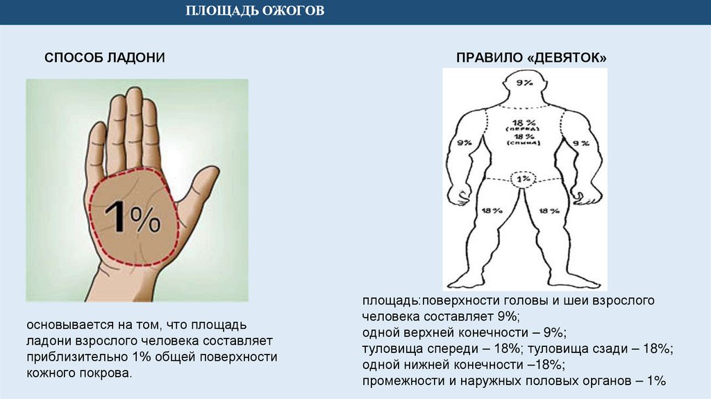 ПЛОЩАДЬ ОЖОГОВ