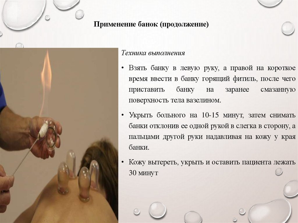 Применение банок (продолжение)