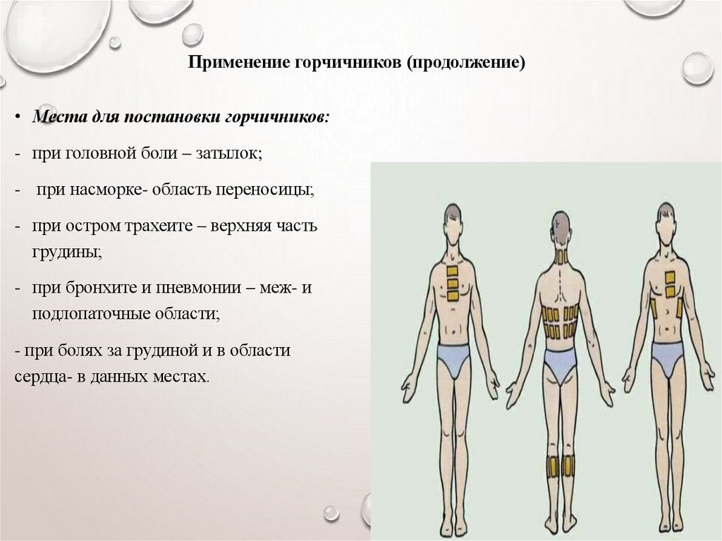 Применение горчичников (продолжение)