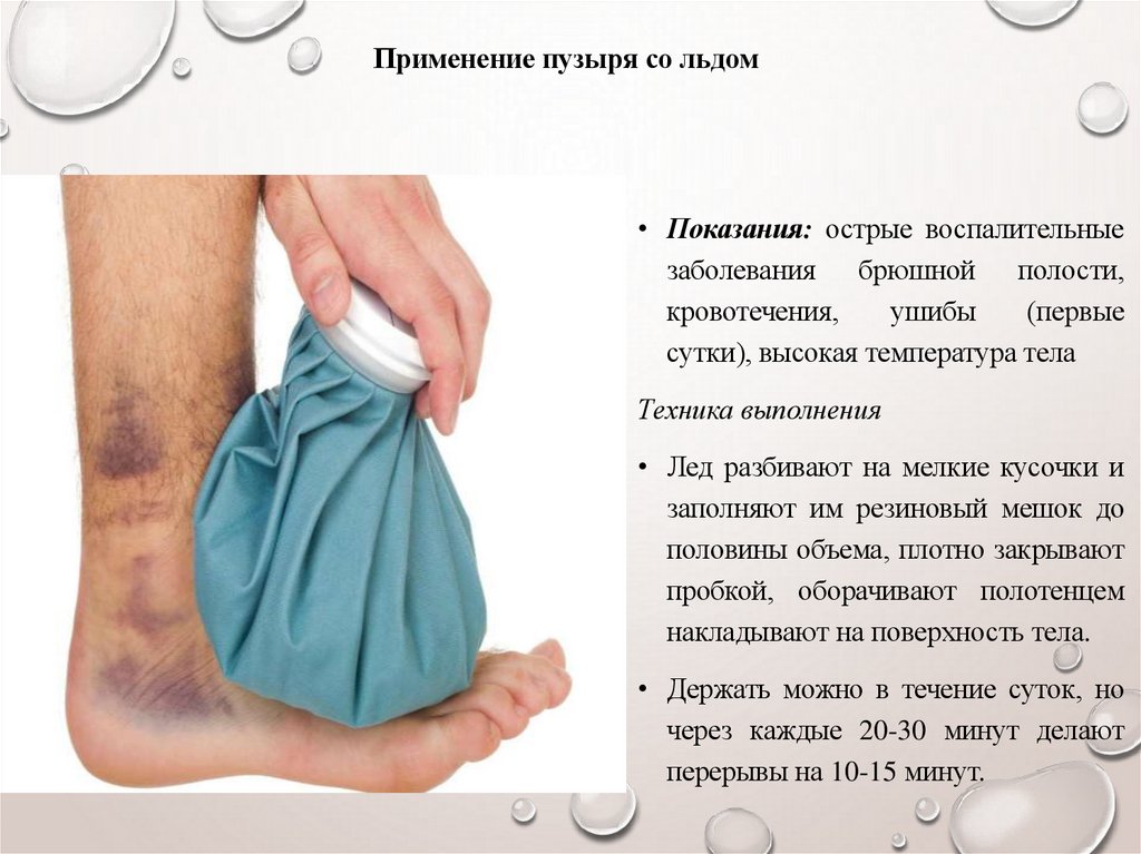 Применение пузыря со льдом