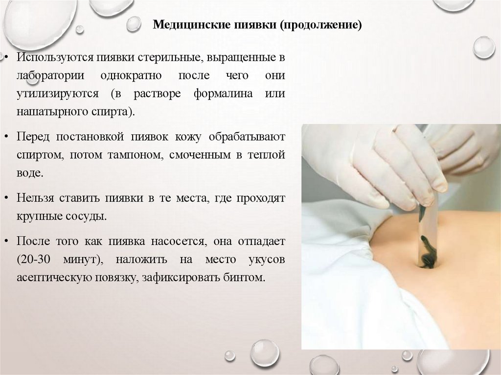 Медицинские пиявки (продолжение)