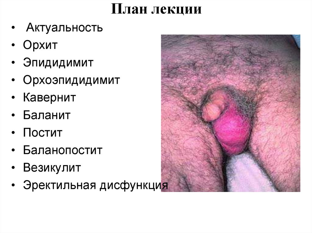 План лекции