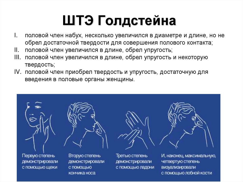 ШТЭ Голдстейна