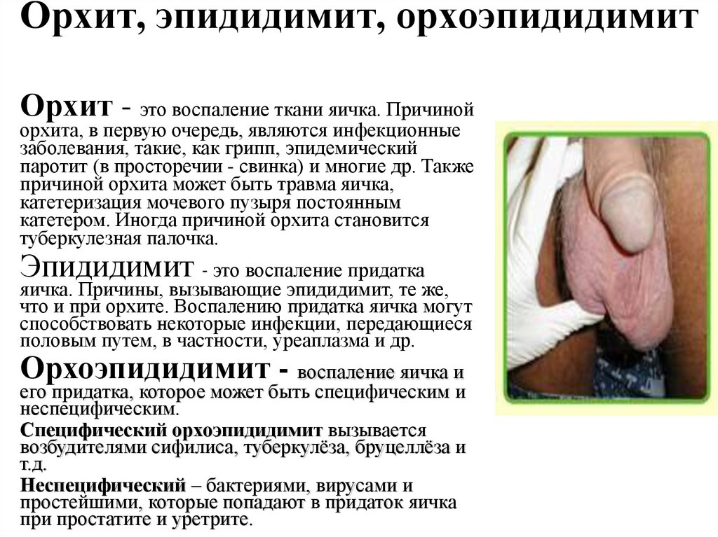 Орхит, эпидидимит, орхоэпидидимит