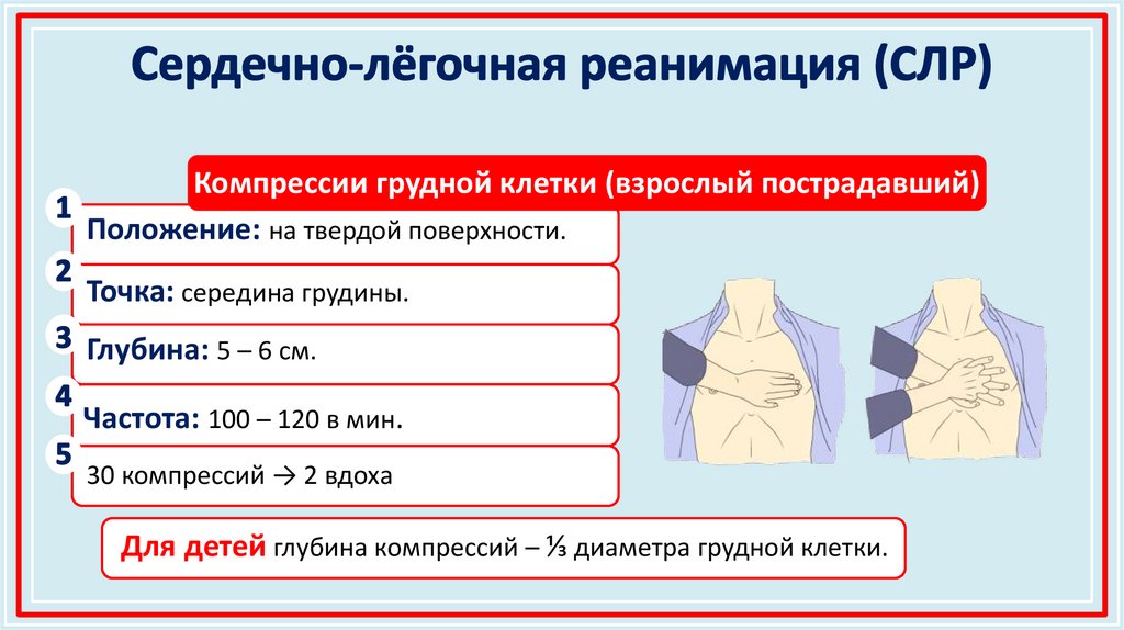 Сердечно‑лёгочная реанимация (СЛР)