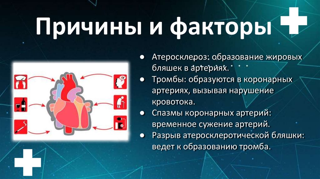 Причины и факторы