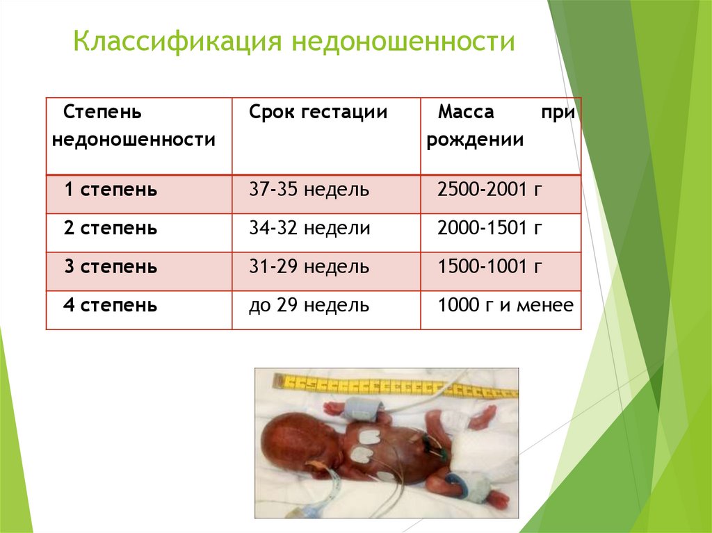 Классификация недоношенности