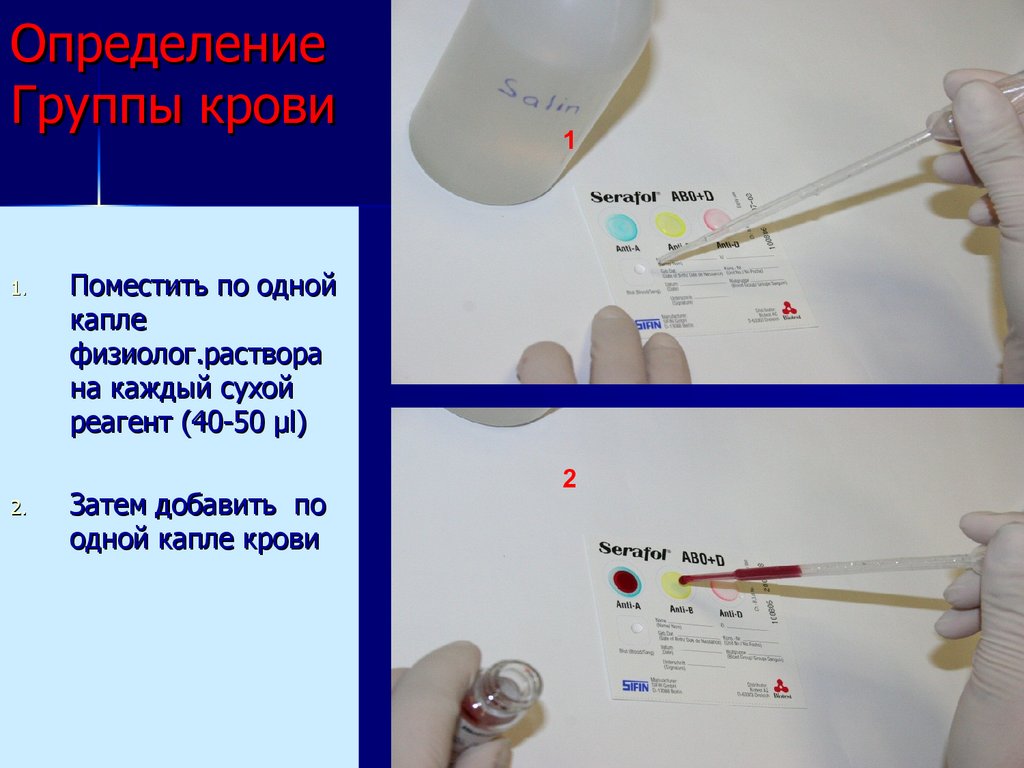 Определение Группы крови