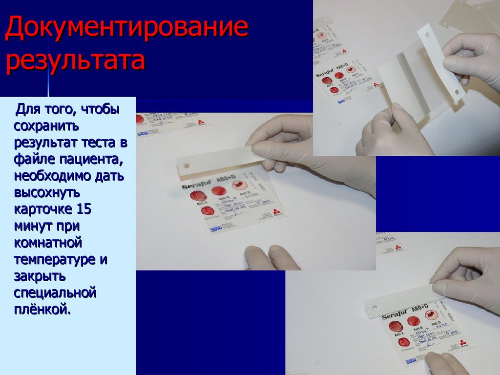 Документирование результата