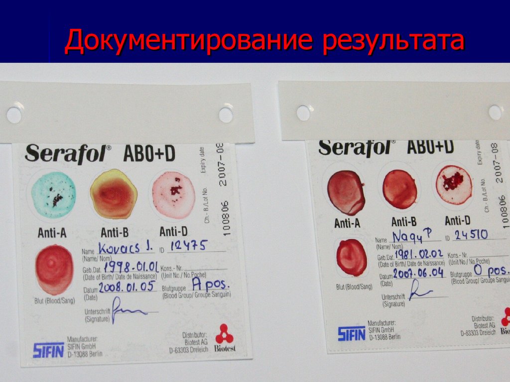 Документирование результата