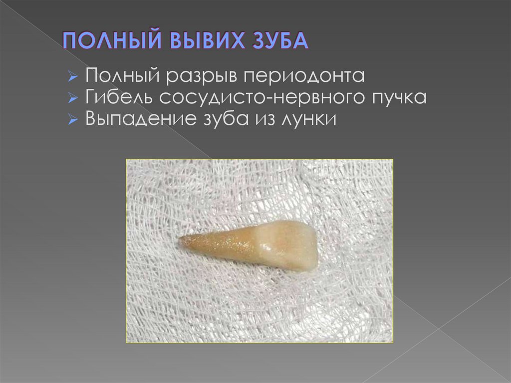 ПОЛНЫЙ ВЫВИХ ЗУБА