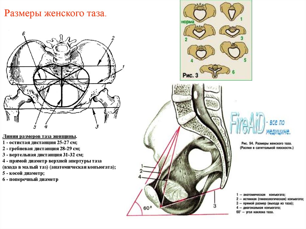 Размеры женского таза.